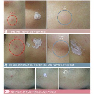 Lotion chấm mụn Bye Bye Blemish