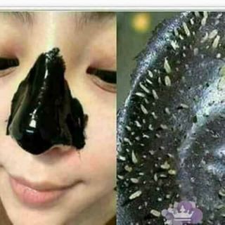Gel lột mụn than tre thảo dược lột cực đã