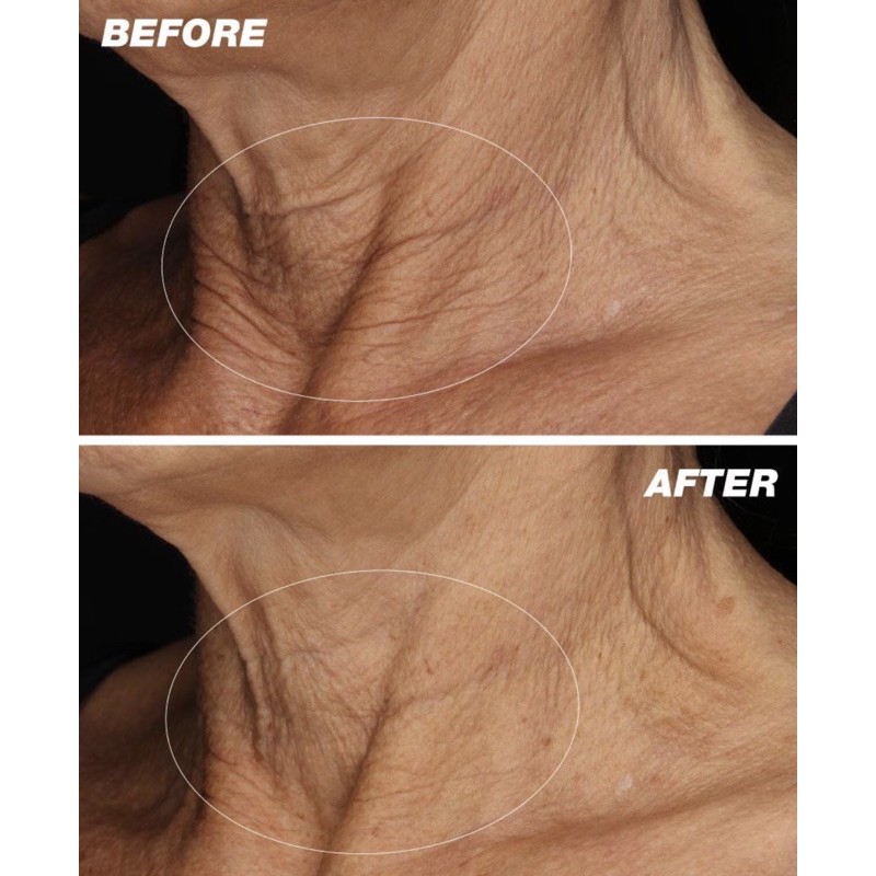 Serum Dermalogica neck fit contour (10ml) - USA - làm săn chắc da cho cổ và ngực | BigBuy360 - bigbuy360.vn