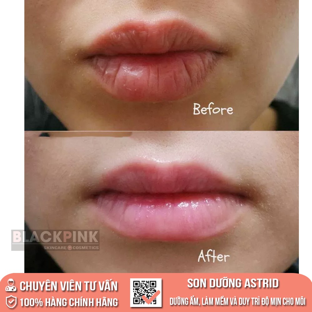Son dưỡng môi mỡ hươu Astrid - Dưỡng ẩm cho môi, giúp môi mềm mại, căng mọng suốt cả ngày | BigBuy360 - bigbuy360.vn