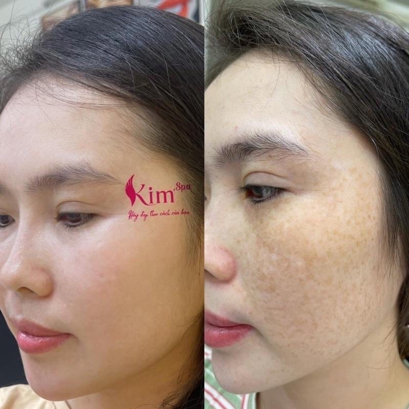 Kem Dưỡng Da Mặt Sau Tái Tạo Độc Quyền Kim Spa Số 33 Dưỡng Trắng Mịn Sáng Da