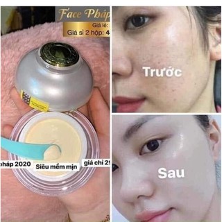 kem face pháp chữ A chinh hãng