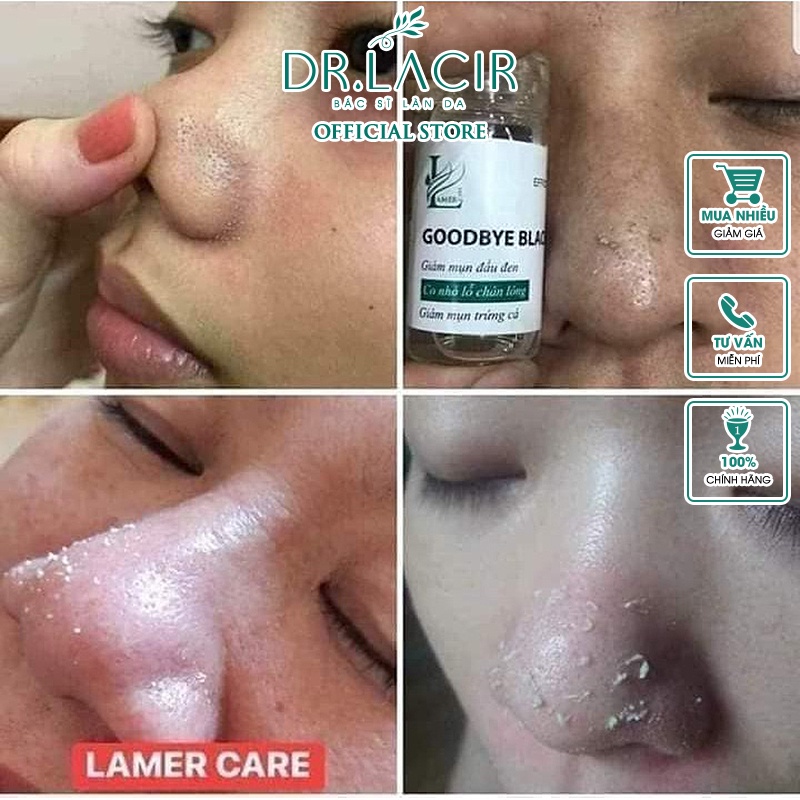 Ủ Mụn Đầu Đen Dr Lacir 20 ml DR101