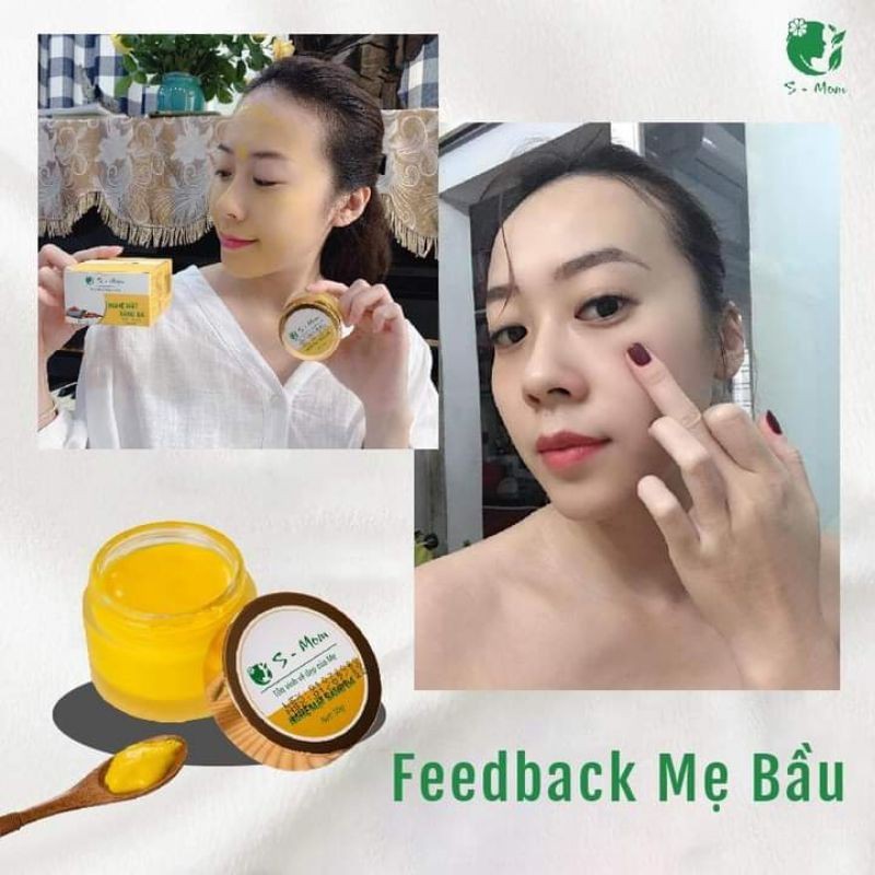 Nghệ Mặt Sáng Da Dưỡng Trắng - Mờ Thâm Mụn S-Mom ( kem nghệ s-mom ) | BigBuy360 - bigbuy360.vn