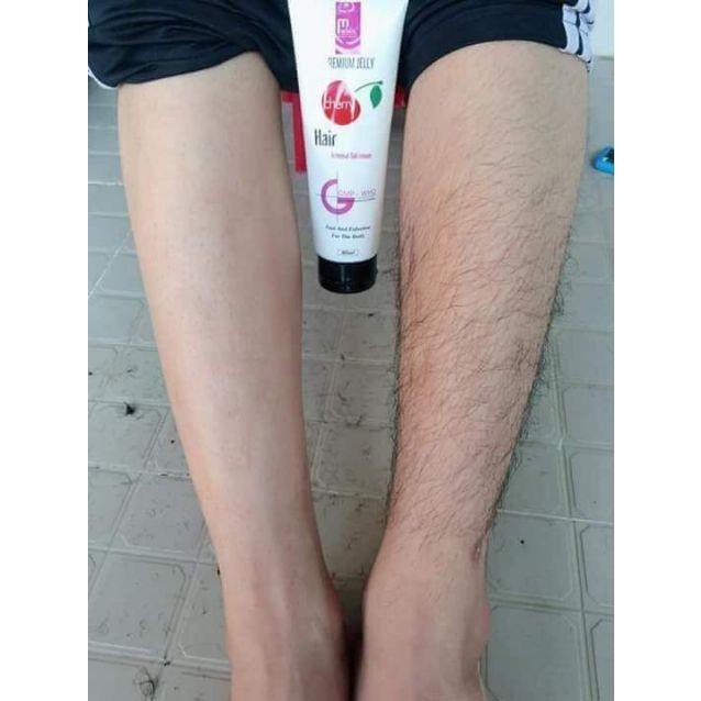 Triệt lông Mwhite | BigBuy360 - bigbuy360.vn