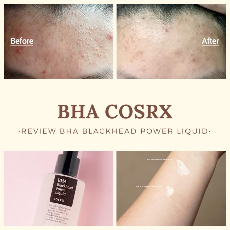 Tẩy Da Chết Hóa Học COSRX BHA Blackhead Power Liquid