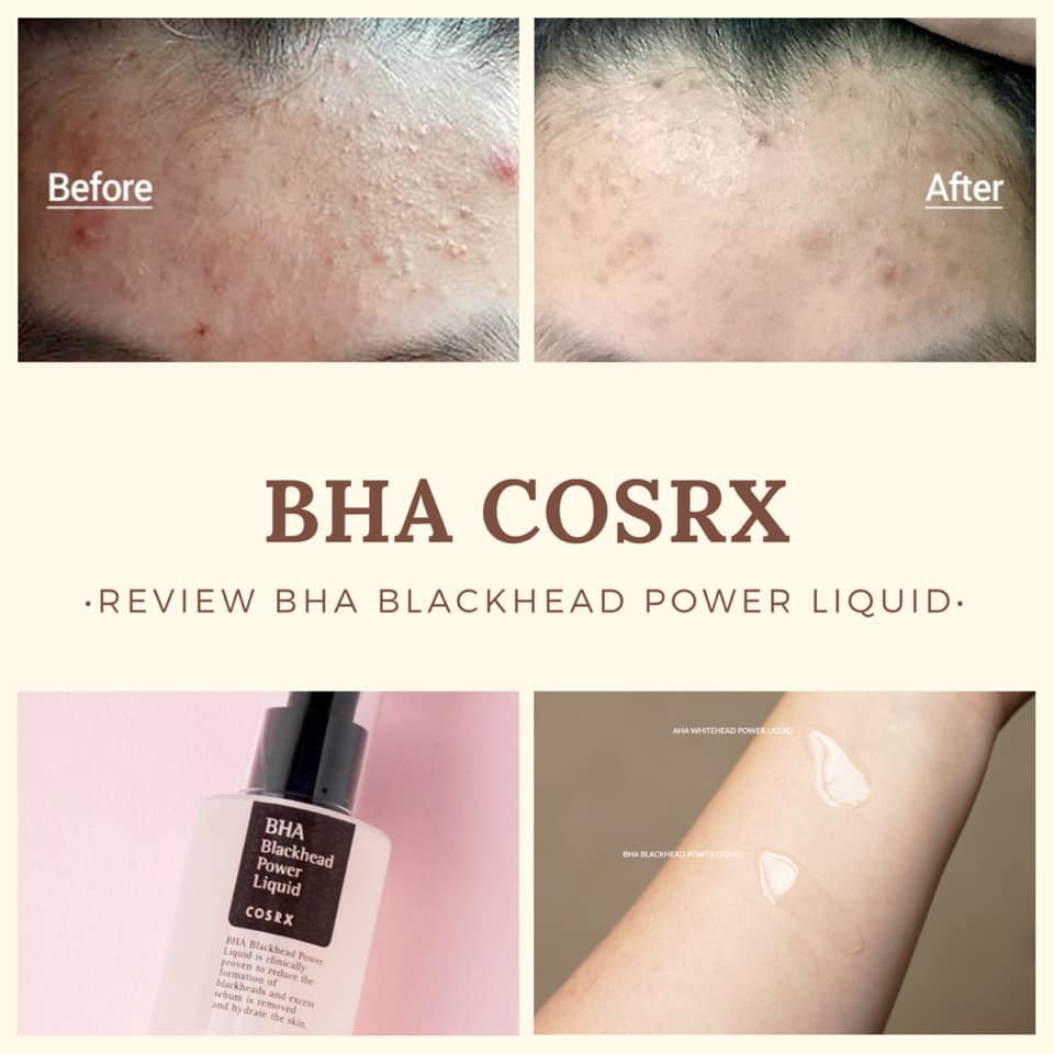 [Date mới nhất] Tẩy Da Chết Hóa Học COSRX BHA Blackhead Power Liquid