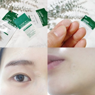 Miếng Dán Mụn Some By Mi Clear Spot Patch
