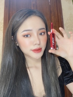Cấy môi baby lips volume