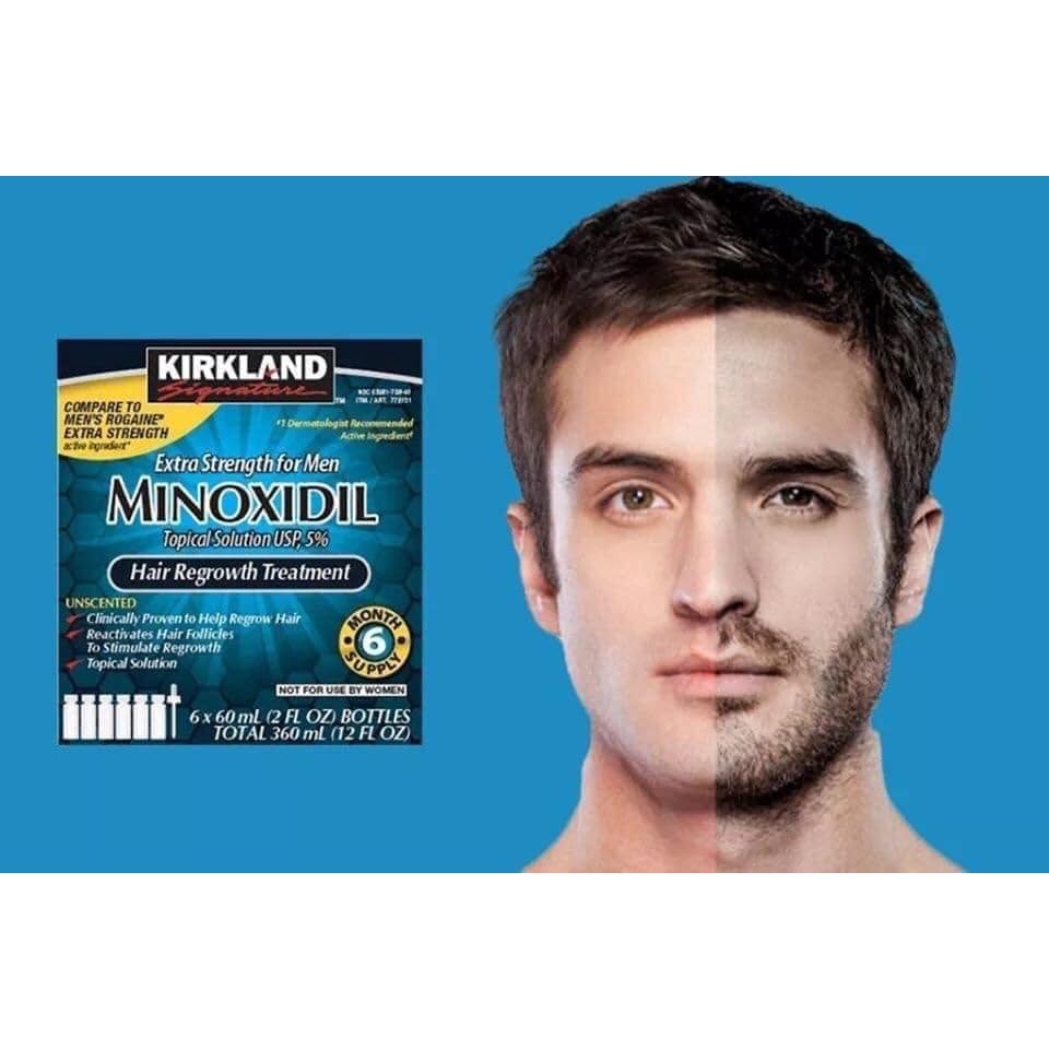 DUNG DỊCH MỌC TÓC MINOXIDIL 5% KIRKLAND CỦA MỸ CHỐNG RỤNG TÓC VÀ HÓI ĐẦU CHO NAM GIỚI