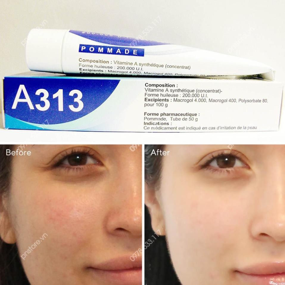 Kem Retinol A313 Chống Lão Hoá Giảm Mụn Xoá Nhăn Pháp 50g