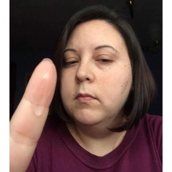 Kem Chấm Mụn Dạng Gel SVR Sebiaclear Cicapeel 15ml