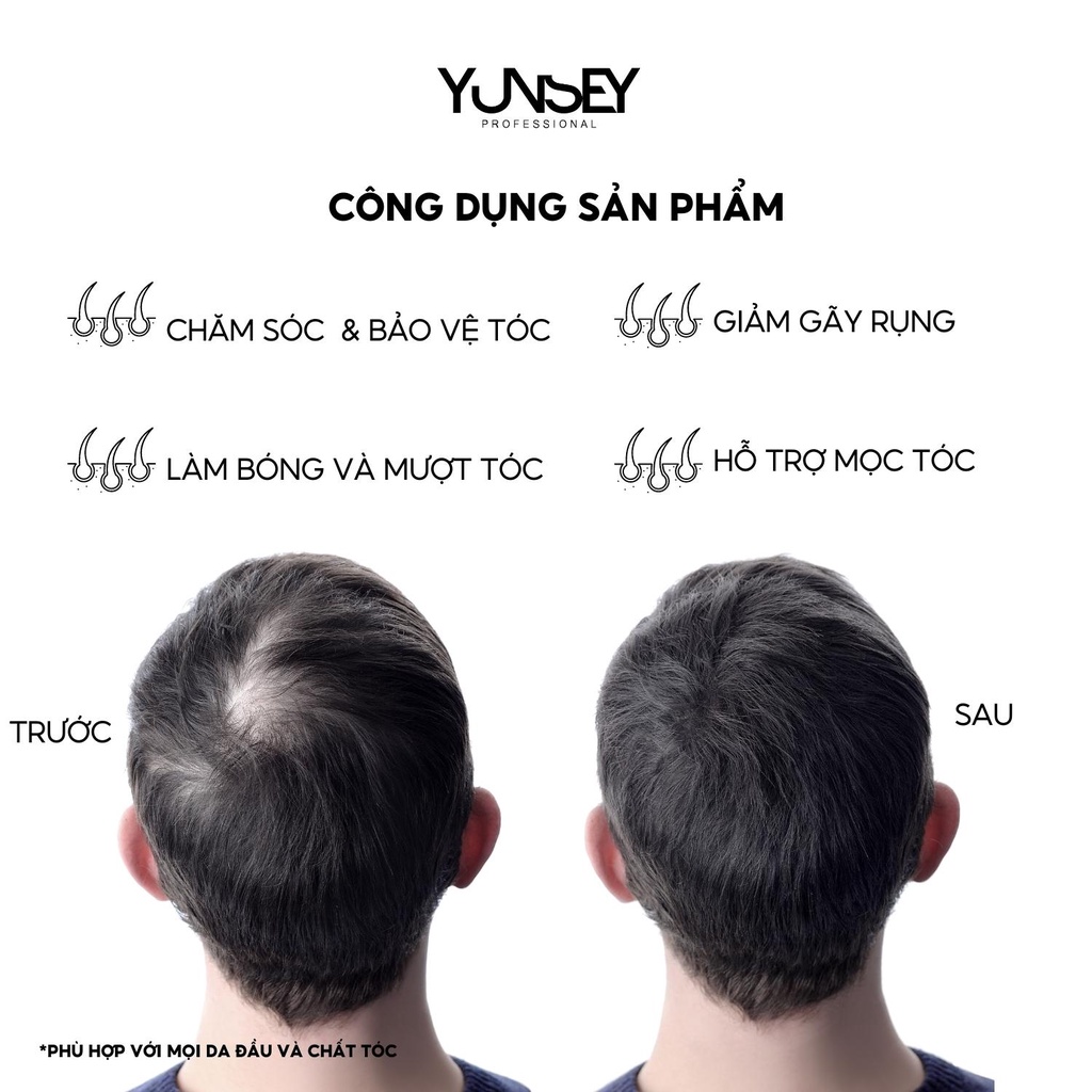 Tinh Chất Giảm Rụng Tóc Yunsey Anti Hair Loss Lotion For Men 100ML