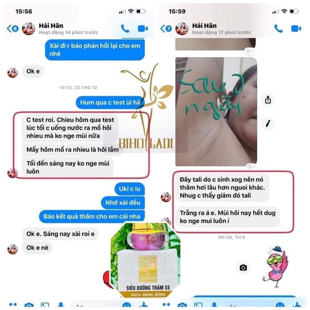 BIHO LADY 5S - SIÊU DƯỠNG THÂM 5S ( Có Sẵn) | BigBuy360 - bigbuy360.vn