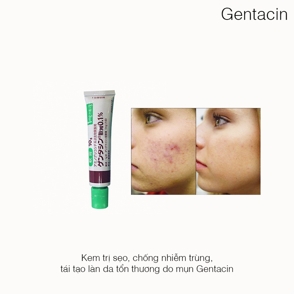 GEL XÓA SẸO GENTACIN OINTMENT 0,1% GENTAMICIN SULFATE - 1 tuýp