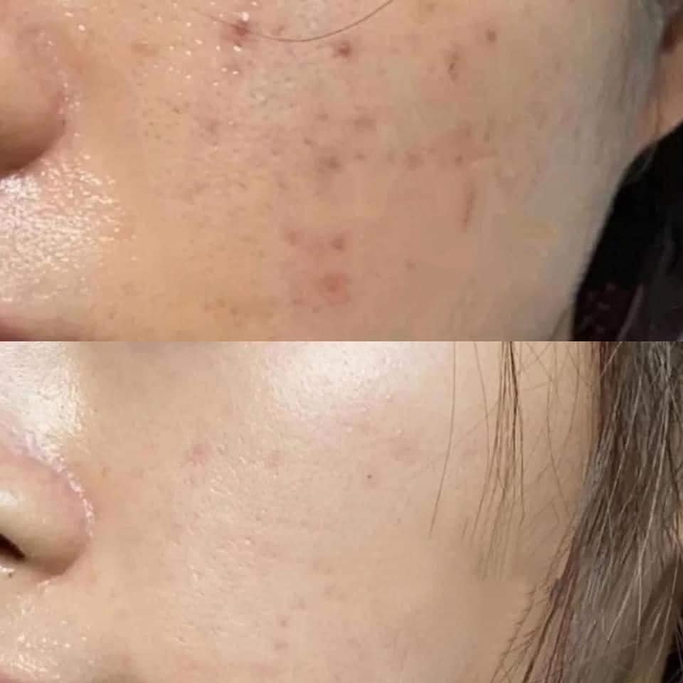 Tinh chất Neogen Dermalogy Real Vitamin C