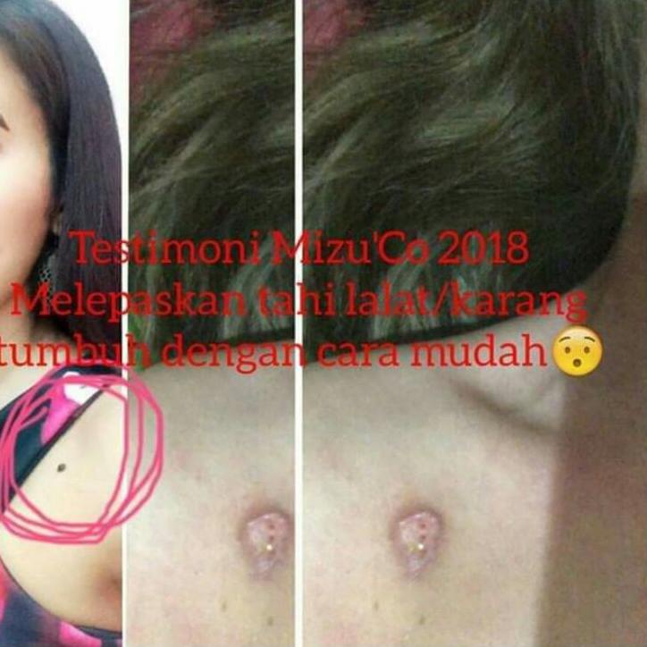 ⭐ Xịt Cố Định Mizuco (Bộ 139) (trims,.) | BigBuy360 - bigbuy360.vn