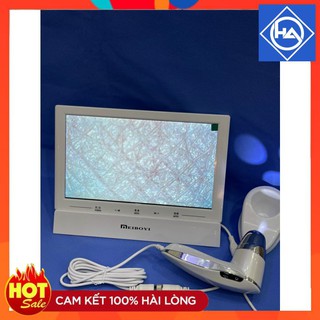 {BH 1 ĐỔI 1} MÁY SOI DA IPAD HÀNG CHÍNH HÃNG SIÊU HOT