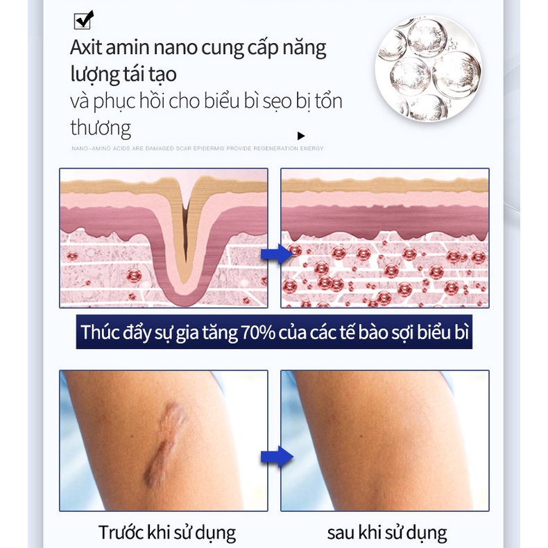 Kem chuyên làm mờ sẹo lâu năm,sẹo lồi lâu năm,Kem chuyên xóa sẹo lồi lâu nămsẹo bỏngsẹo mụntrầy xước.mờ sẹo thâm mụnmờ thâm khổi phục da