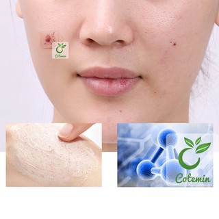 Sữa rửa mặt ONE SPRING ốc sên