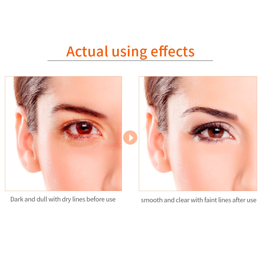 1 PCS đôi mặt nạ mắt Breylee có vitamin C làm giảm quầng thâm mắt và dưỡng ẩm cho da