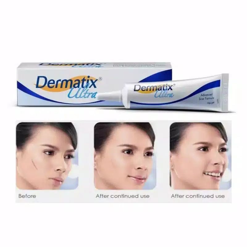 (hàng Mới Về) Kem Trị Sẹo Dermatix 15g Tiện Dụng Chất Lượng Cao