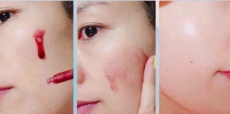 Serum The Ordinary – AHA 30% + BHA 2% Peeling Solution 30ml