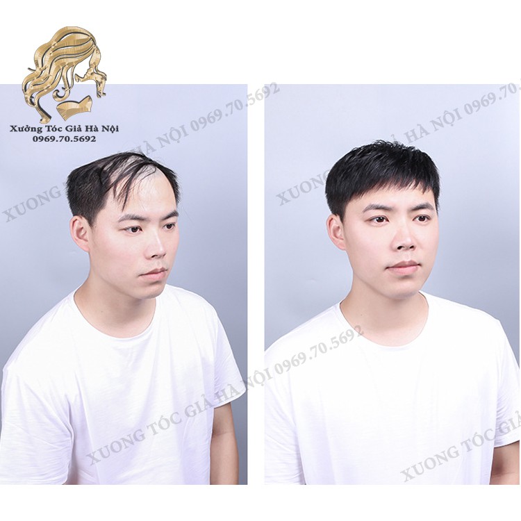 Mái hói nam ❤️ 100% tóc thật ❤️ xưởng tóc giả Hà Nội