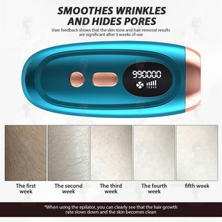 Máy Triệt Lông Toàn Thân IPL 99000 Xung , Sử Dụng Công Nghệ Cao Kết Hợp Trẻ Hóa Làn Da - Tặng Kèm Kính Bảo Vệ ,Dao Cạo