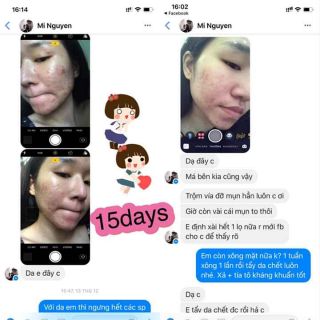 (💥CHÍNH HÃNG) Serum trị mụn Secret Life (hàng sẵn có).
