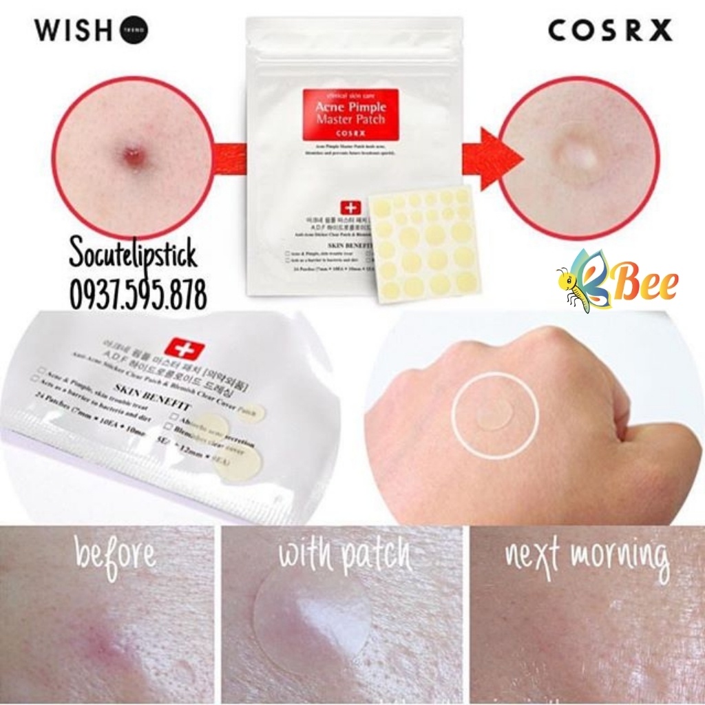 Miếng dán mụn Cosrx Acne Pimple Master 24 patches