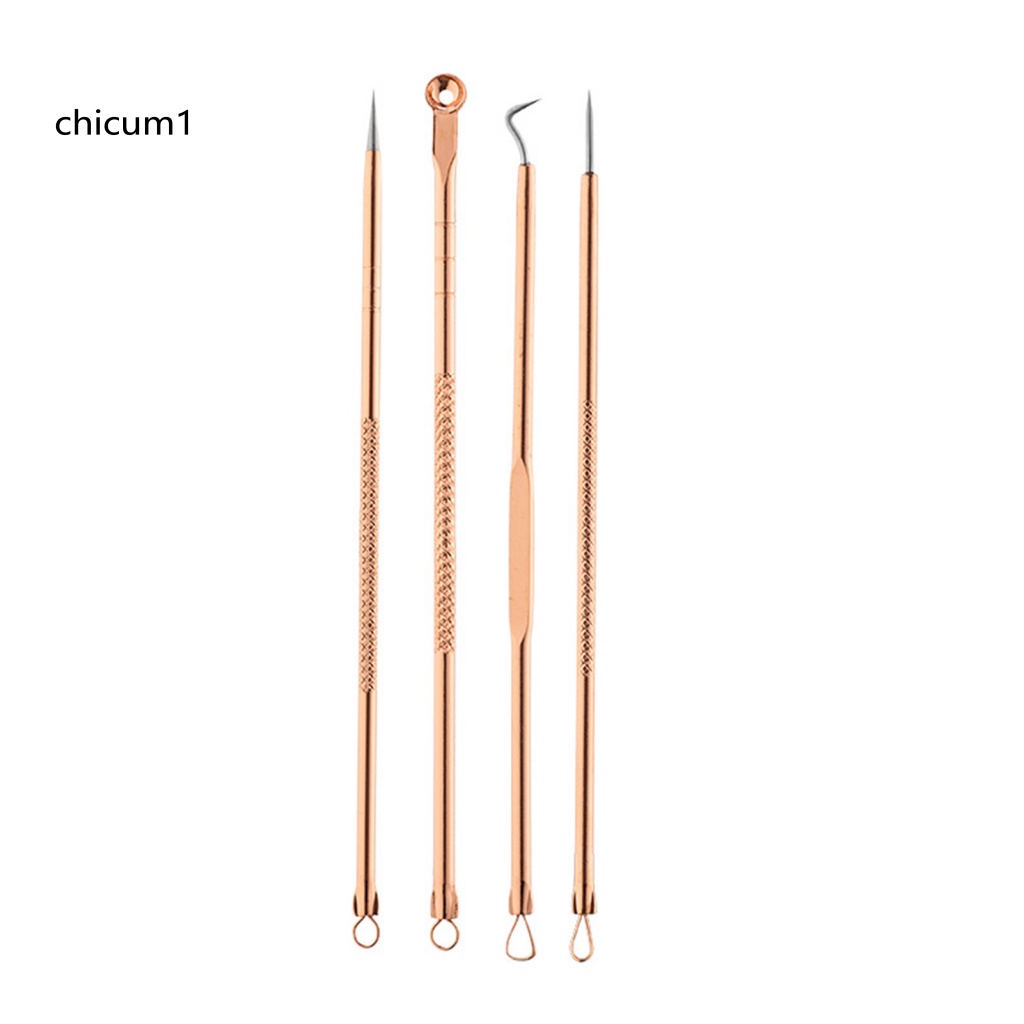 Set 4 Dụng Cụ Nặn Mụn Đầu Đen An Toàn Tiện Dụng