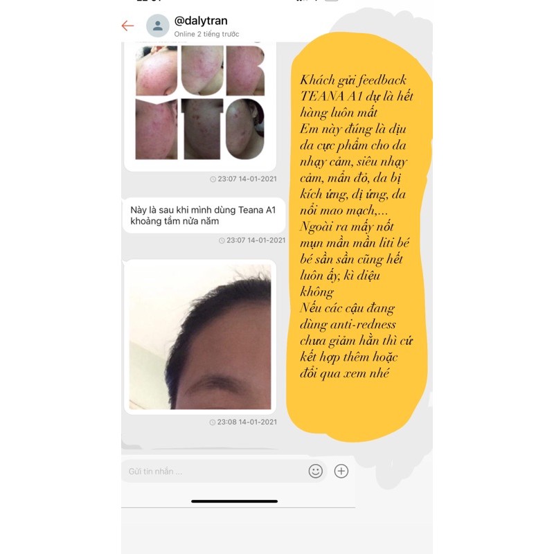 Serum Teana A1 A3 cho da yếu mỏng, giãn nổi mao mạch dưới da | BigBuy360 - bigbuy360.vn