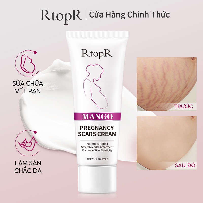 Kem Rtopr Cho Phụ Nữ Mang Thai Hỗ Trợ Giảm Sẹo Rạn Da Chống Lão Hóa Và Nếp Nhăn 40g | BigBuy360 - bigbuy360.vn