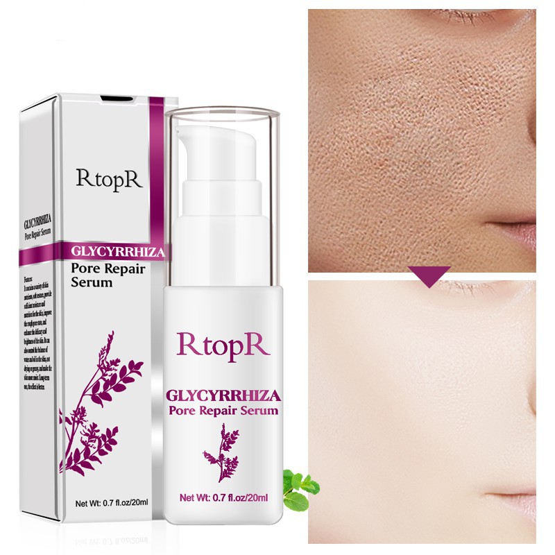 (Hàng Mới Về) Serum Rtopr Dưỡng Ẩm Kiểm Soát Dầu Thu Nhỏ Lỗ Chân Lông