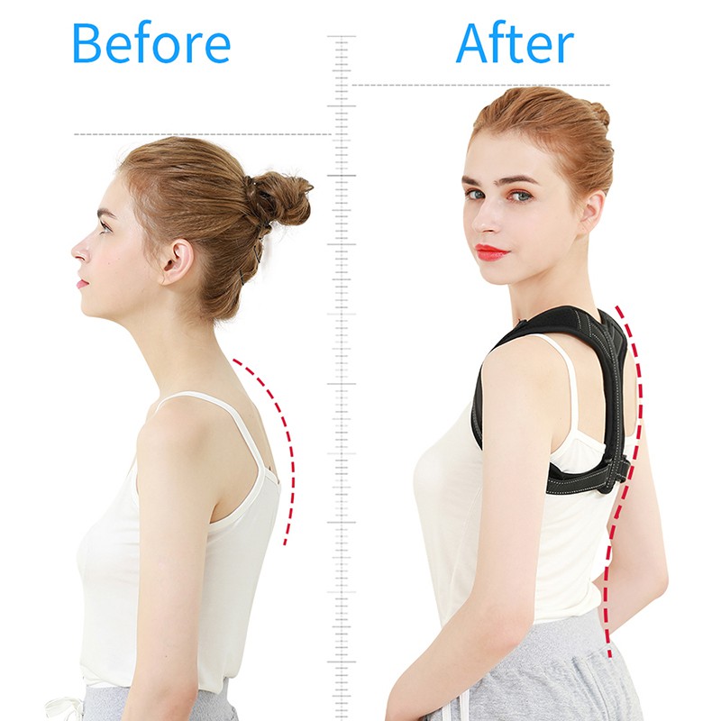 Đai Đeo Điều Chỉnh Tư Thế Lưng Junlaikang Chống Gù Giảm Đau Hiệu Quả