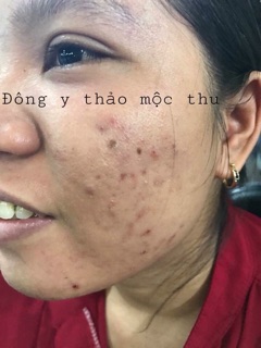 Đông Y Thảo Mộc Thu