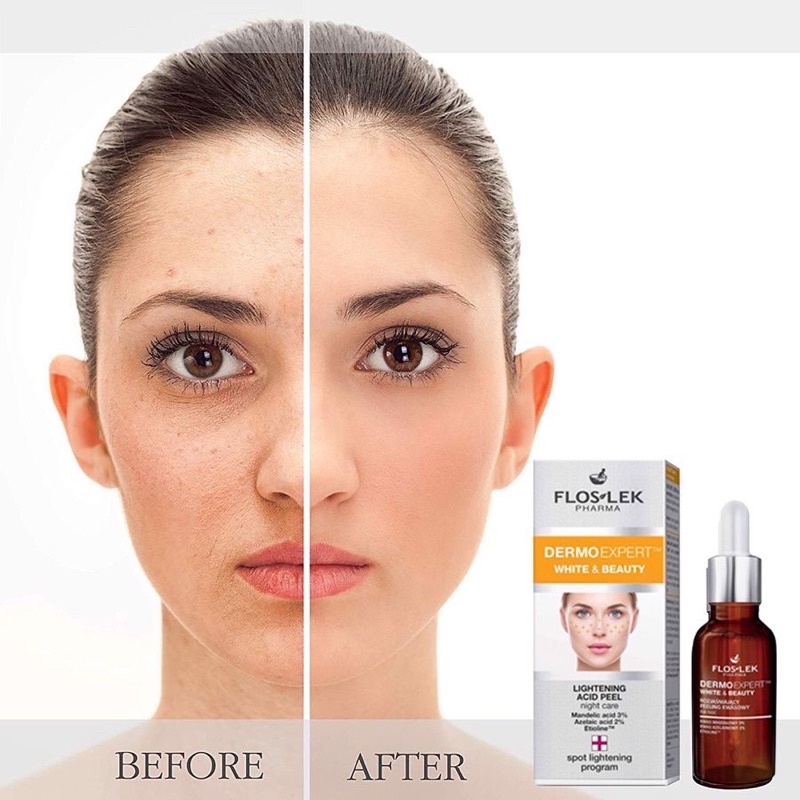 Tinh chất Peel tái tạo da Floslek Dermo Expert White &amp; Beauty tẩy tế bào chết, làm sáng da, mờ đốm nâu 30ml