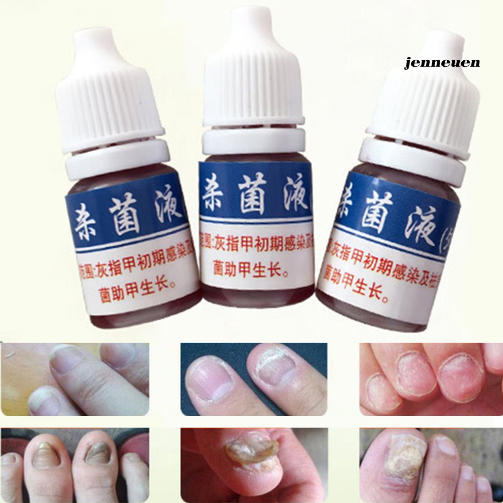 [Hàng mới về] Dung dịch diệt chữa bệnh nấm móng tay chân an toàn 10ml