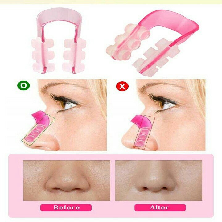 Kẹp Nâng Mũi Nose Up Siêu Nhỏ Gọn