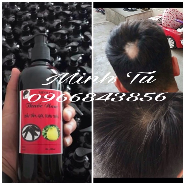 Dầu gội đầu thuốc nam Minh Tú