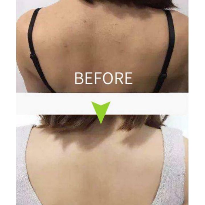 Xà Phòng Ngừa Mụn Lưng For Back Pelican Nhật