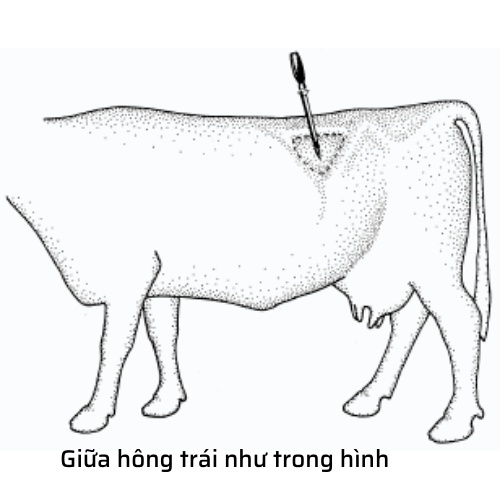 Troca thông hơi dạ cỏ trâu bò Dương Ninh - kèm 3 kim 11cm 13cm 14,5cm TC61