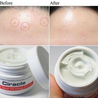 Kem Giảm Mụn Ciracle Red Spot Cream
