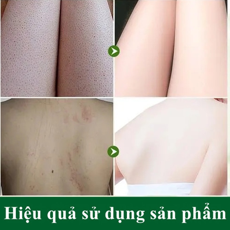 Tẩy da chết body 250g tẩy tế bào chết cơ thể YZKMSKIN làm trắng da toàn thân Làm cho da mịn màng và mềm mại | BigBuy360 - bigbuy360.vn