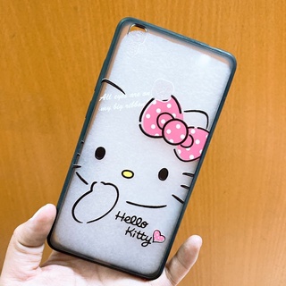 Ốp Vivo V3max