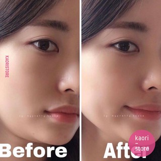 MẶT NẠ THON GỌN GIẢM MỠ NỌNG