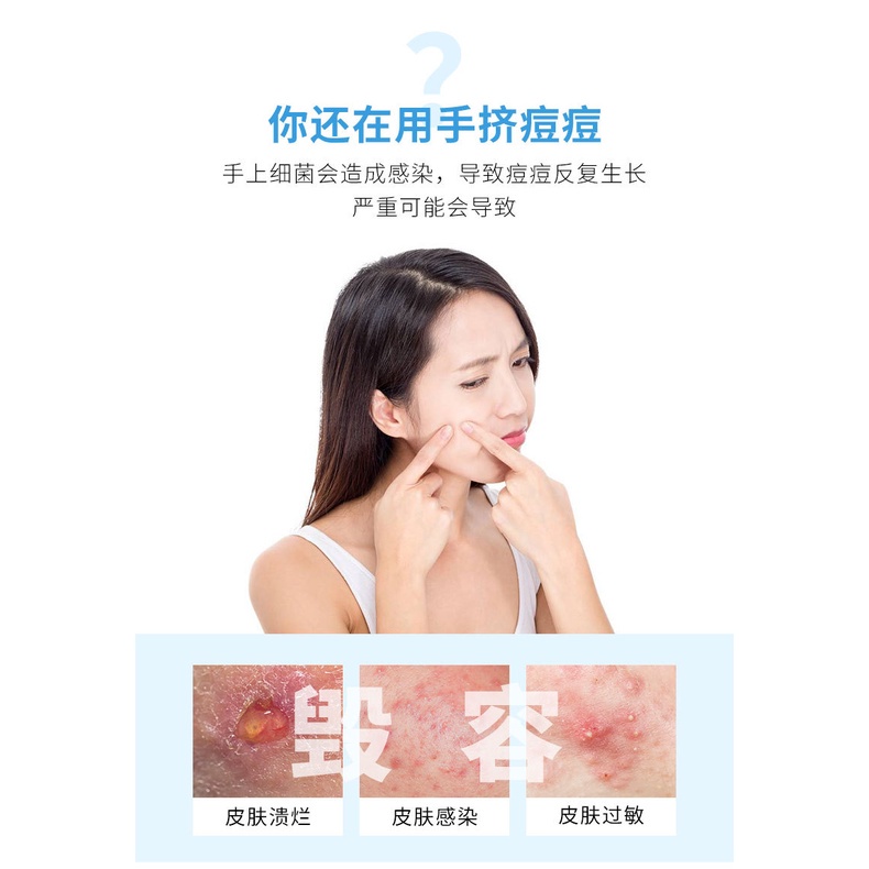 Bộ 4 Cây Nặn Mụn 8 Đầu Maycreate Dụng Cụ Nặn Mụn Bằng Inox Cao Cấp Luxuka MC09