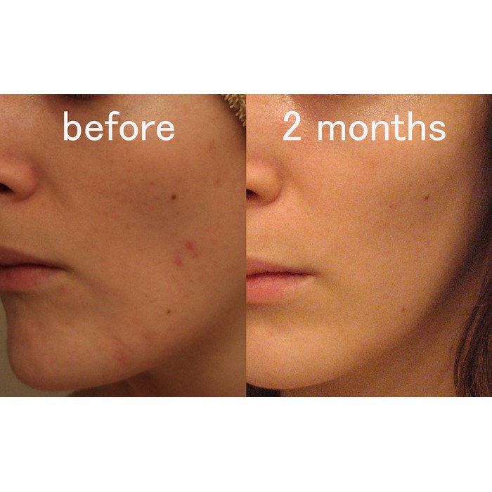 [Sỉ-Rẻ] Tinh chất ốc sên khử mụn, tái tạo da Images – SVN [Lẻ-Sỉ]