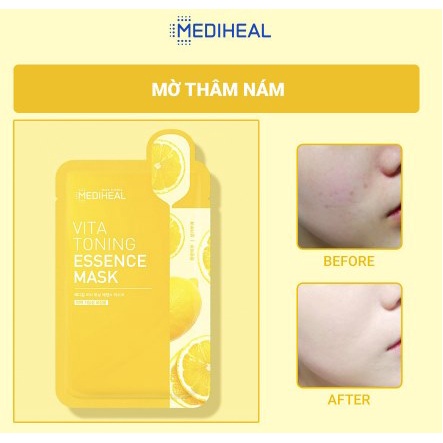 [100% AUTH] Mặt Nạ Giấy Mediheal Mask 20ML Mẫu Mới 2021 | BigBuy360 - bigbuy360.vn